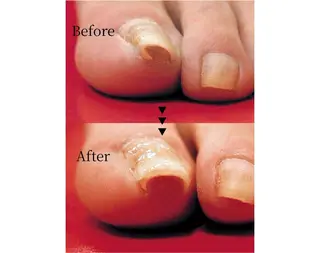 ネイル Blé nailのネイルデザイン