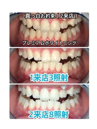 WhiteningBeauty吉祥寺店所属・店舗代表 タクミのその他イメージ