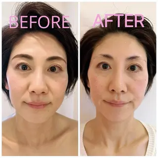 韓国式小顔コルギ BE-CUTE北参道のエステ・リラクイメージ