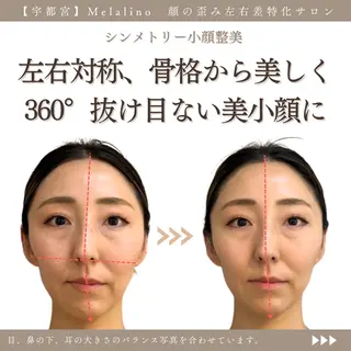 美容整体サロン Melalinoのエステ・リラクイメージ