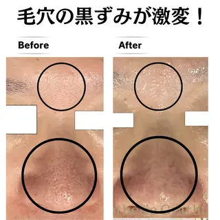 毛穴・ニキビ専門 エステグレースティーのエステ・リラクイメージ