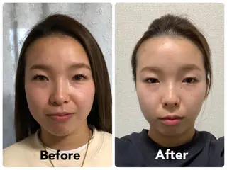 小顔矯正サロン スターローズのエステ・リラクイメージ