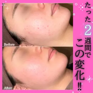痩身&美肌サロン 堀米✨のその他イメージ