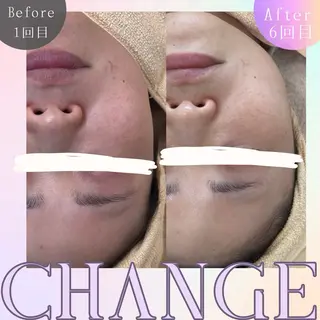 肌質管理専門店 Lé pia　AMIのエステ・リラクイメージ