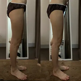 ハイパーナイフ専門店　Salon de COCO所属・Salon de COCOのエステ・リラクイメージ