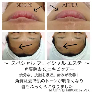 ビューティー ミロワールのエステ・リラクイメージ