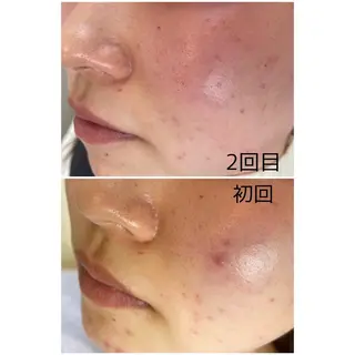 soresfy makiのマツエク・マツパデザイン