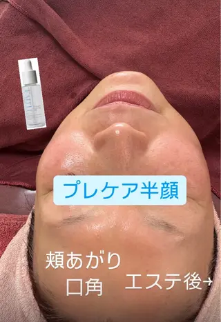 Lien オーナー　山口智嘉のエステ・リラクイメージ