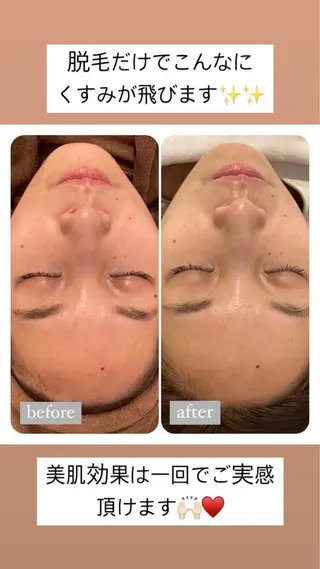 美肌脱毛専門サロン Dione栄店のエステ・リラクイメージ