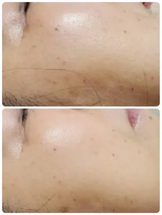 Astorie 相模大野エステのその他イメージ