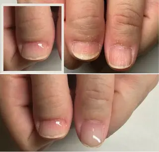 ネイル 深爪矯正専門店 ネイルサロンKUUのネイルデザイン