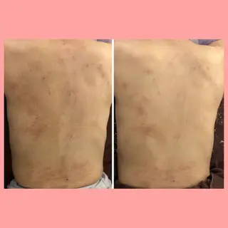 ショート カラー パーマ ヘアアレンジ メンズ キッズ ネイル マツエク・マツパ ニキビ・肌質改善専門 ♡人生が変わるサロンのエステ・リラクイメージ