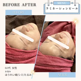 美白/韓国肌管理 💎 KOTOMIのエステ・リラクイメージ