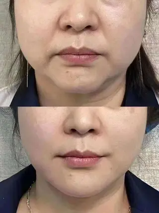 ネイル aliaハーブ水光店 エステティシャン募集のエステ・リラクイメージ