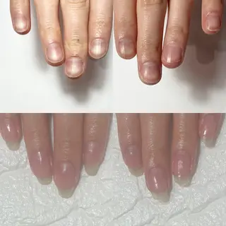 ネイル 自爪育成・巻き爪 補正講師　津蔵のネイルデザイン