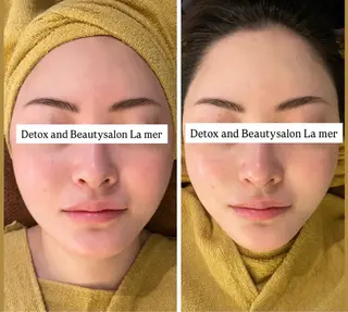 耳ツボ/体質改善/ 温活La mer月島のその他イメージ