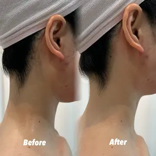 🫧美しい素肌へ🫧 今成柚乃のその他イメージ