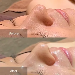 実村💚BLEZE 毛穴/脱毛/痩身のエステ・リラクイメージ