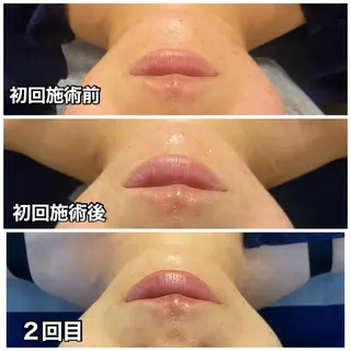 🌴Beauty Salon LANAのエステ・リラクイメージ