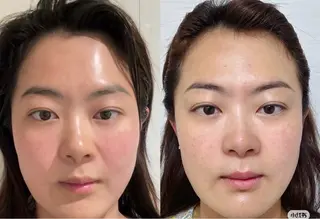 愛維美水光美肌専門店 メンズレディースokのエステ・リラクイメージ