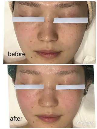 De I'm 名古屋栄店所属・原 いず美のエステ・リラクイメージ