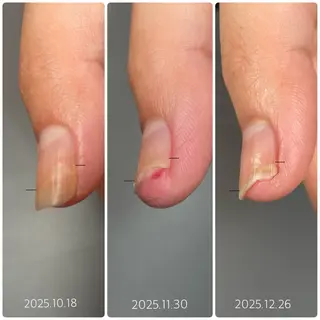 ネイル 後藤 ももえのネイルデザイン