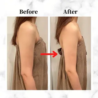 12Dハイフ💗 最強小顔のエステ・リラクイメージ