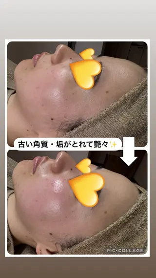 W MISATOのエステ・リラクイメージ