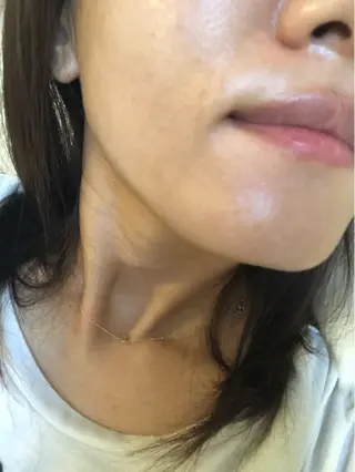 Momo Eggsのエステ・リラクイメージ