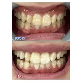 Ｍ渋谷 ホワイトニングのエステ・リラクイメージ