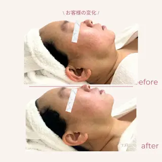 aimer 服部のその他イメージ