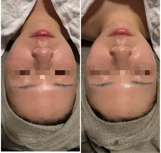 lumi riseのエステ・リラクイメージ