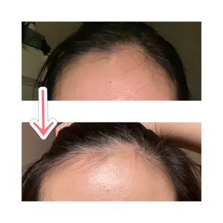 ビューティーサロン ソナタのエステ・リラクイメージ