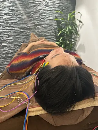 小顔矯/美容鍼/鍼灸 BeauJuのその他イメージ