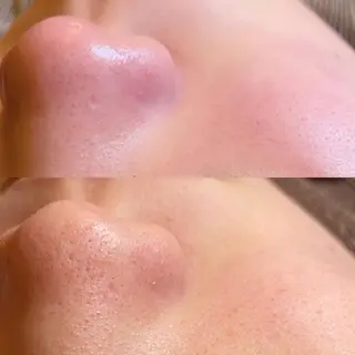 トータルビューティー マウロアのエステ・リラクイメージ