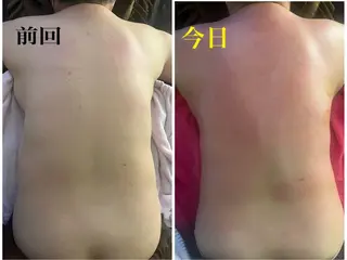 アロマ･美容鍼･カッ ピング「麗」鍼灸院のエステ・リラクイメージ