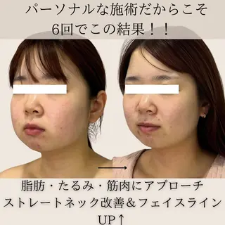 第一印象専門サロン ADISEのエステ・リラクイメージ