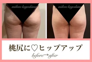 miilove 鹿児島店のエステ・リラクイメージ