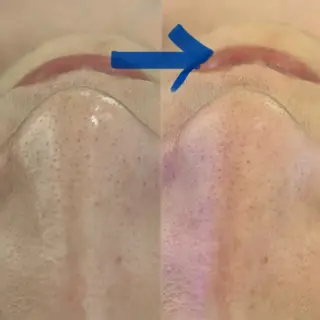 Blue Moon 【ブルームーン】のエステ・リラクイメージ