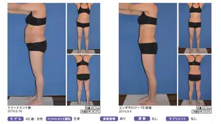 オレンジバナナ 県央店のエステ・リラクイメージ