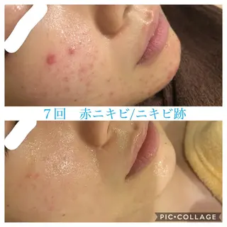 ロング カラー パーマ ヘアアレンジ キッズ ネイル マツエク・マツパ EnsorClair 代表 野口真央のエステ・リラクイメージ