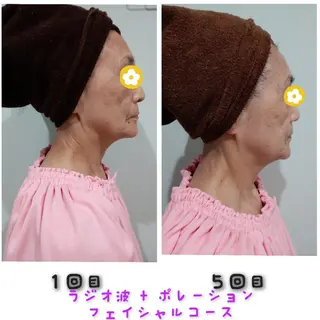 エステティクサロン Moon-bellのエステ・リラクイメージ