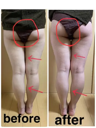 ネイル 痩身/脱毛/ネイル HARUKAのエステ・リラクイメージ