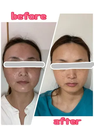 長谷川 玲美のエステ・リラクイメージ