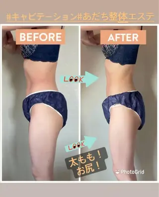 あだち整体エステ 首肩背中のゆるめぐのエステ・リラクイメージ