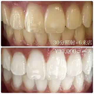 ホワイトニングルーム 横浜店のその他イメージ