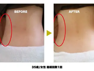 【痩身/ダイエット】 オーバイワン横浜🍓のエステ・リラクイメージ