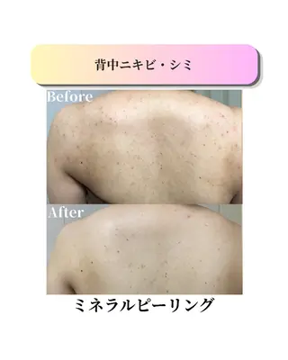 ローズフィールド 森岡朋美のエステ・リラクイメージ