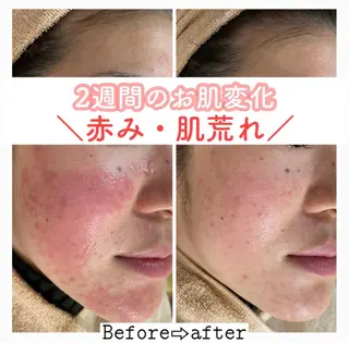 都度払い肌改善専門店 店長二上文香のエステ・リラクイメージ