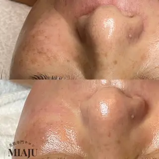 美肌専門サロン MIAJUのエステ・リラクイメージ